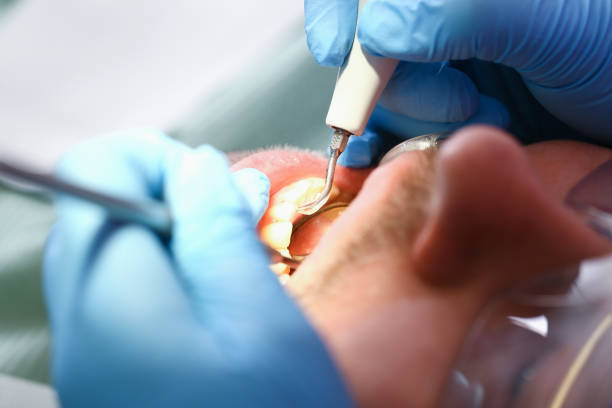 Best Pediatric Emergency Dentist in Collegedale, TN