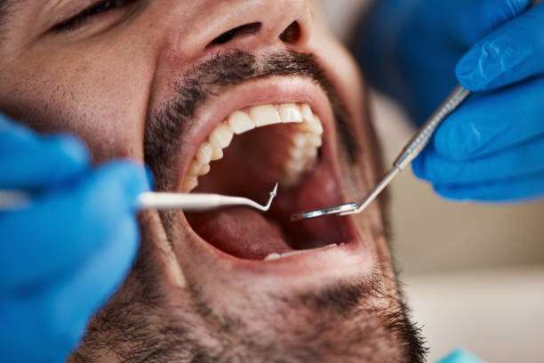 Best Emergency Dental Extractions in Collegedale, TN